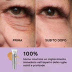 Crema Occhi Anti-Età – Dì Addio a Borse e Occhiaie